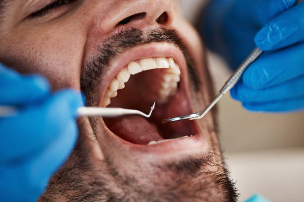 Best Emergency Dental Surgery in Vander, NC